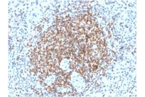 ABIN6383843 to BCL2 was successfully used to stain cells primarily in the germinal centre of human spleen sections.
