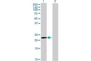 Western Blot analysis of MS4A8B expression in transfected 293T cell line by MS4A8B MaxPab polyclonal antibody. (Membrane-Spanning 4-Domains, Subfamily A, Member 8 (MS4A8) (AA 1-250) 抗体)