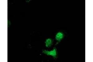 Anti-DSTN mouse monoclonal antibody (ABIN2454365) immunofluorescent staining of COS7 cells transiently transfected by pCMV6-ENTRY DSTN (RC203419). (Destrin 抗体)