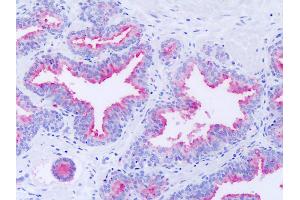 Anti-GPR63 antibody IHC of human prostate. (GPR63 抗体  (Extracellular Domain))