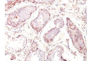 Formalin-fixed, paraffin-embedded human Testicular Carcinoma stained with MAGE-1 Monoclonal Antibody (MZ2E/838). (MAGEA1 抗体)
