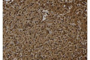 ABIN6272379 at 1/100 staining Human liver tissue by IHC-P. (OTUB2 抗体  (Internal Region))