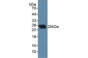 Western blot analysis of Rat Testis Tissue. (CLEC10A 抗体  (AA 71-239))