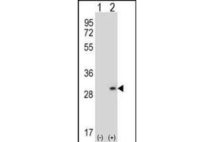 Western blot analysis of DPT (arrow) using rabbit polyclonal DPT Antibody (N-term) (ABIN656571 and ABIN2845833). (Dermatopontin 抗体  (N-Term))