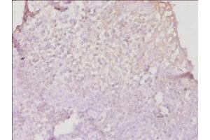 Immunohistochemistry of paraffin-embedded human tonsil tissue using ABIN7155585 at dilution of 1:50 (HLA-DPB1 抗体  (AA 30-225))