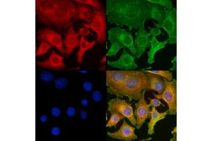 ABIN6260728 and ABIN6277053 staining Hela cells by IF/ICC. (CDKN3 抗体  (Internal Region))