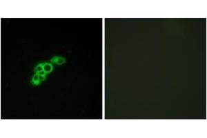 Immunofluorescence analysis of MCF7 cells, using FSHR Antibody. (FSHR 抗体  (AA 278-327))