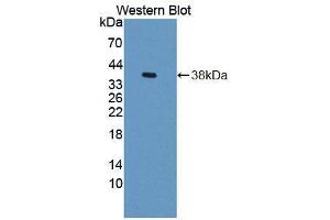Western blot analysis of the recombinant protein. (GTF3A 抗体  (AA 71-365))