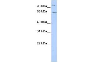 WB Suggested Anti-SPATA16 Antibody Titration: 0. (SPATA16 抗体  (N-Term))