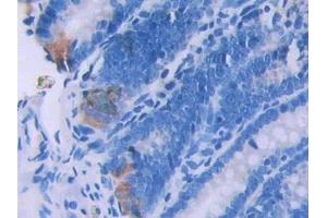 Immunohistochemistry (IHC) image for anti-Bone Morphogenetic Protein 6 (BMP6) (AA 375-502) antibody (ABIN7432313)