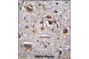 PK14 Antibody (Center /) (ABIN656420 and ABIN2845711) immunohistochemistry analysis in forlin fixed and paraffin embedded hun brain tissue followed by peroxidase conjugation of the secondary antibody and DAB staining. (MAPK14 抗体  (AA 158-192))