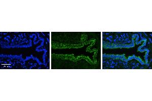 Immunohistochemistry (IHC) image for anti-Plasminogen Activator Inhibitor 1 (SERPINE1) (N-Term) antibody (ABIN2782976) (PAI1 抗体  (N-Term))