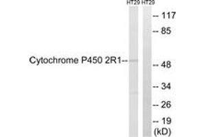 Western blot analysis of extracts from HT29 cells, using Cytochrome P450 2R1 Antibody. (CYP2R1 抗体  (AA 251-300))