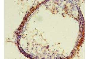 Immunohistochemistry of paraffin-embedded human testis tissue using ABIN7151992 at dilution of 1:100 (ERLIN1 抗体  (AA 27-346))