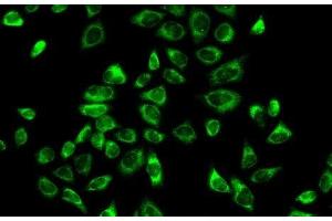 Immunofluorescence analysis of A-549 cells using HSD3B2 Polyclonal Antibody (HSD3B2 抗体)