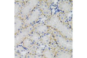 Immunohistochemistry of paraffin-embedded mouse kidney using SLC1A4 antibody (ABIN5971578) (40x lens). (SLC1A4 抗体)