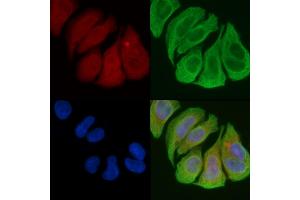 ABIN6258488 and ABIN6274479 staining Hela cells(45 min of heat-shock) by IF/ICC. (IP6K3 抗体  (Internal Region))