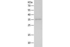 Western Blotting (WB) image for Interleukin 21 (IL21) (AA 18-146) protein (His-IF2DI Tag) (ABIN7123572)