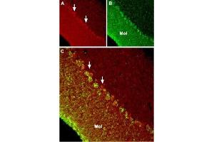 Expression of TRPC6 in mouse cerebellumImmunohistochemical staining of mouse cerebellum using Anti-TRPC6 Antibody (ABIN7043824, ABIN7043968 and ABIN7043969).