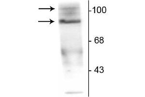 Western Blotting (WB) image for anti-Progesterone Receptor (PGR) (pSer190) antibody (ABIN361517)