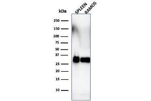Western Blot Analysis of Ramos cells and human spleen tissue lysate using HLA-DRB Monoclonal Antibody (SPM288). (HLA-DRB1 抗体)