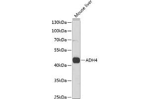 Western blot analysis of extracts of mouse liver, using  antibody (ABIN6131220, ABIN6136577, ABIN6136578 and ABIN6221110) at 1:1000 dilution. (ADH4 抗体  (AA 1-380))