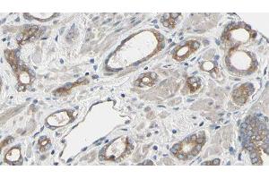 ABIN6277492 at 1/100 staining Human prostate tissue by IHC-P. (RRM2 抗体  (C-Term))