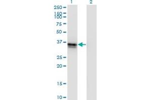 Western Blot analysis of FRZB expression in transfected 293T cell line by FRZB monoclonal antibody (M01), clone 4F7. (FRZB 抗体  (AA 102-190))