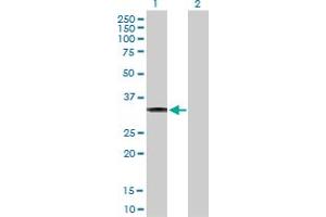 Western Blot analysis of CBR3 expression in transfected 293T cell line by CBR3 MaxPab polyclonal antibody. (CBR3 抗体  (AA 1-277))