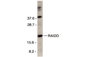 Western Blotting (WB) image for anti-CASP2 and RIPK1 Domain Containing Adaptor with Death Domain (CRADD) (C-Term) antibody (ABIN1030612) (CRADD 抗体  (C-Term))