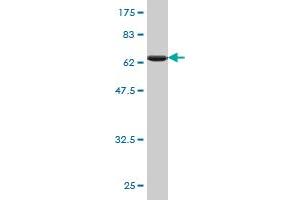 Western Blot detection against Immunogen (65. (PCBP2 抗体  (AA 1-362))