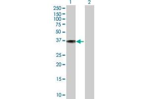 Western Blot analysis of DFNA5 expression in transfected 293T cell line ( H00001687-T01 ) by DFNA5 MaxPab polyclonal antibody. (DFNA5 抗体  (AA 1-295))
