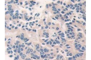 Immunohistochemistry (IHC) image for anti-Cat Eye Syndrome Chromosome Region, Candidate 1 (CECR1) (AA 30-511) antibody (ABIN7430045)
