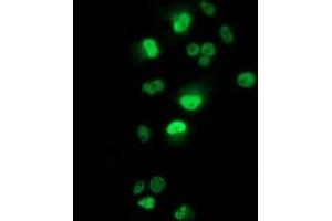 Immunofluorescence (IF) image for anti-Tumor Protein P53 (TP53) antibody (ABIN1499973) (p53 抗体)