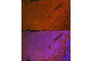 Immunofluorescence analysis of rat spleen using SHIP11 Rabbit mAb (ABIN7267882) at dilution of 1:100 (40x lens). (INPP5D 抗体)