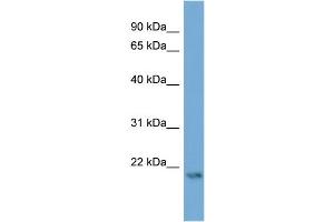 WB Suggested Anti-ATG12  Antibody Titration: 0. (ATG12 抗体  (Middle Region))