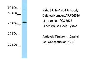 Western Blotting (WB) image for anti-6-phosphofructo-2-Kinase/fructose-2,6-Biphosphatase 4 (PFKFB4) (Middle Region) antibody (ABIN2786783) (PFKFB4 抗体  (Middle Region))