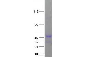 Cyclin Y Protein (CCNY) (Transcript Variant 1) (Myc-DYKDDDDK Tag)