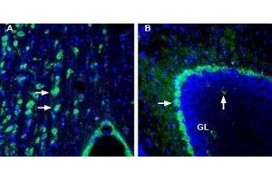 Expression of DP2 receptor (CRTH2/GPR44) in rat medial septum and mouse cerebellum - Immunohistochemical staining of perfusion-fixed frozen rat and mouse brain sections with Anti-CRTH2/GPR44 (extracellular) Antibody (ABIN7043564, ABIN7045118 and ABIN7045119), (1:200), followed by goat-anti-rabbit-AlexaFluor-488. (Prostaglandin D2 Receptor 2 (PTGDR2) (AA 270-283), (Extracellular) 抗体)