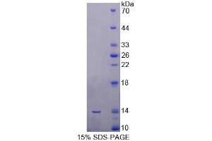 SDS-PAGE analysis of Human SRP9 Protein. (SRP9 蛋白)