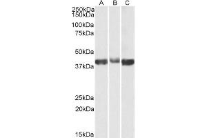 ABIN2613377 (0. (ALDOA 抗体  (AA 86-96))
