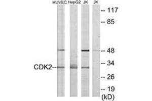 Western blot analysis of extracts from HuvEc/HepG2/Jurkat cells, using CDK2 Antibody. (CDK2 抗体  (AA 231-280))
