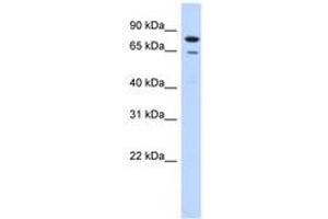 Image no. 1 for anti-Homolog of Yeast RecQ-mediated Genome Instability 1 (RMI1) (AA 71-120) antibody (ABIN6740966) (RMI1 抗体  (AA 71-120))