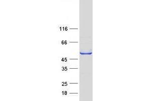 Western Blotting (WB) image for Zinc Finger, MYND-Type Containing 10 (ZMYND10) protein (Myc-DYKDDDDK Tag) (ABIN2735914)