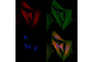 ABIN6264983 and ABIN6266656 staining  cells by IF/ICC. (SENP1 抗体  (N-Term))