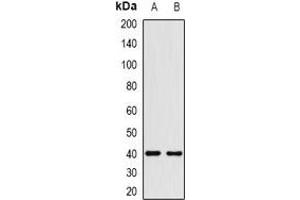Western blot analysis of HMG-20A expression in HEK293T (A), Hela (B) whole cell lysates. (HMG20A 抗体)