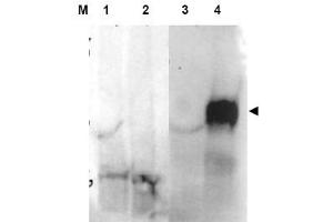 Image no. 1 for anti-Fibroblast Activation Protein, alpha (FAP) (Internal Region) antibody (ABIN401429) (FAP 抗体  (Internal Region))