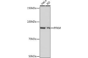 Western blot analysis of extracts of various cell lines, using PFKM Rabbit mAb (ABIN1678746, ABIN7101548, ABIN7101549 and ABIN7101550) at 1:1000 dilution. (PFKM 抗体)