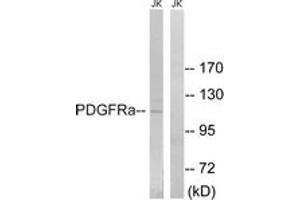 Western blot analysis of extracts from Jurkat cells, using PDGFRa (Ab-849) Antibody. (PDGFRA 抗体  (AA 816-865))