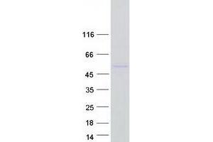 Western Blotting (WB) image for Fatty Acid Desaturase 2 (FADS2) protein (Myc-DYKDDDDK Tag) (ABIN2720682)